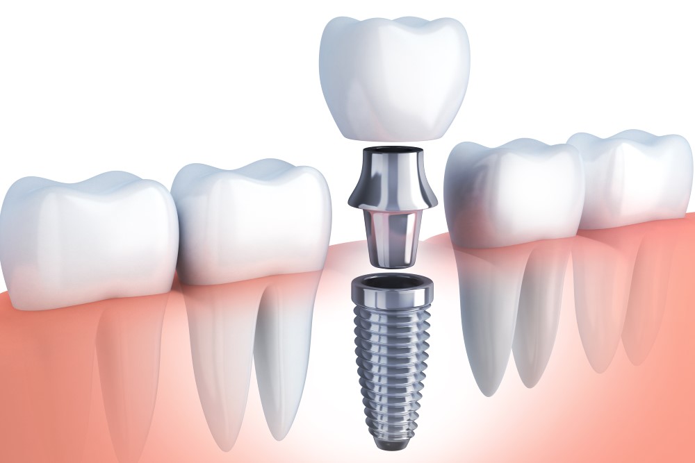 Home Park Dental 4
